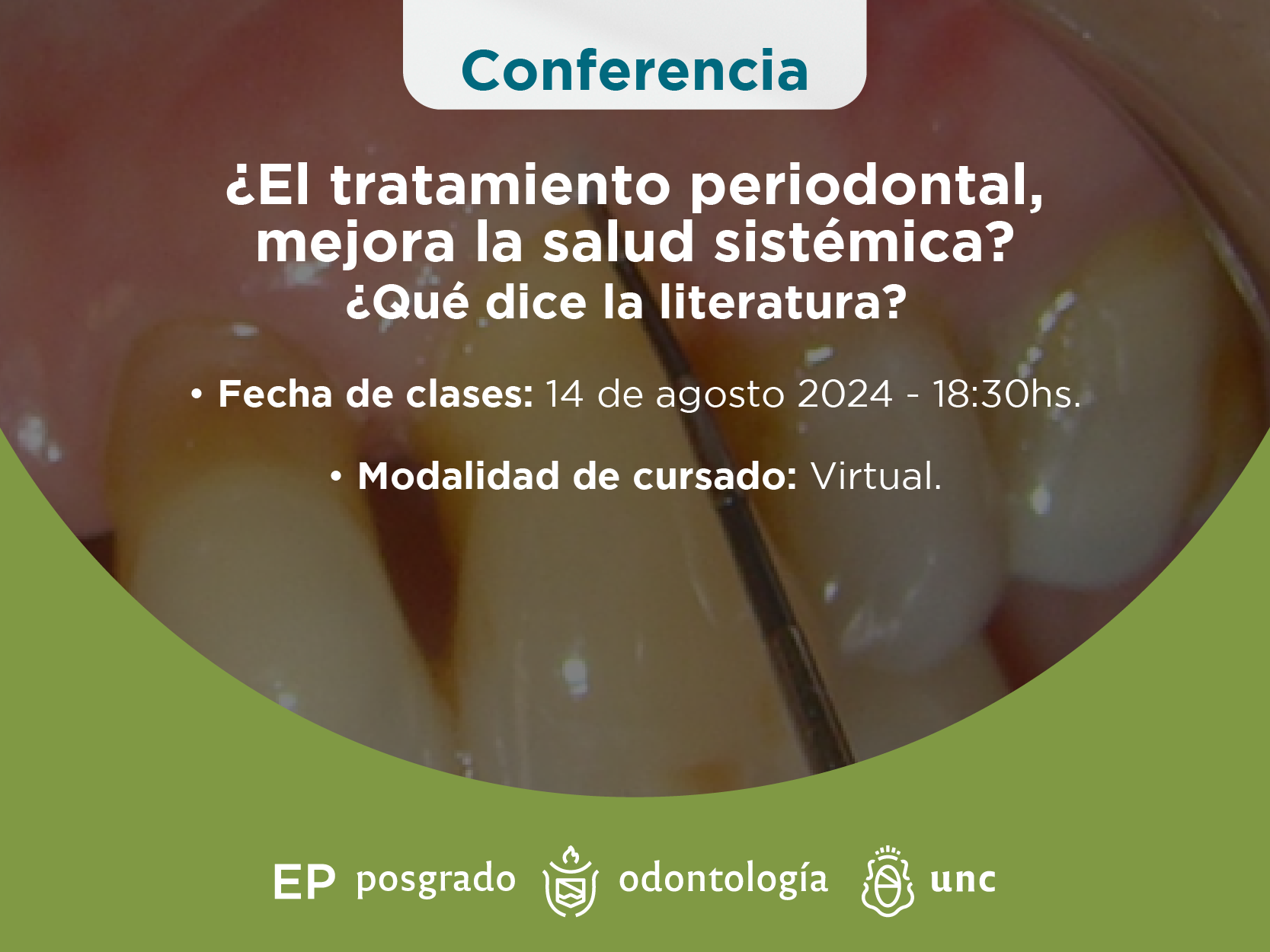 ¿El tratamiento periodontal, mejora la salud sistémica? ¿Qué dice la literatura?Virtual.