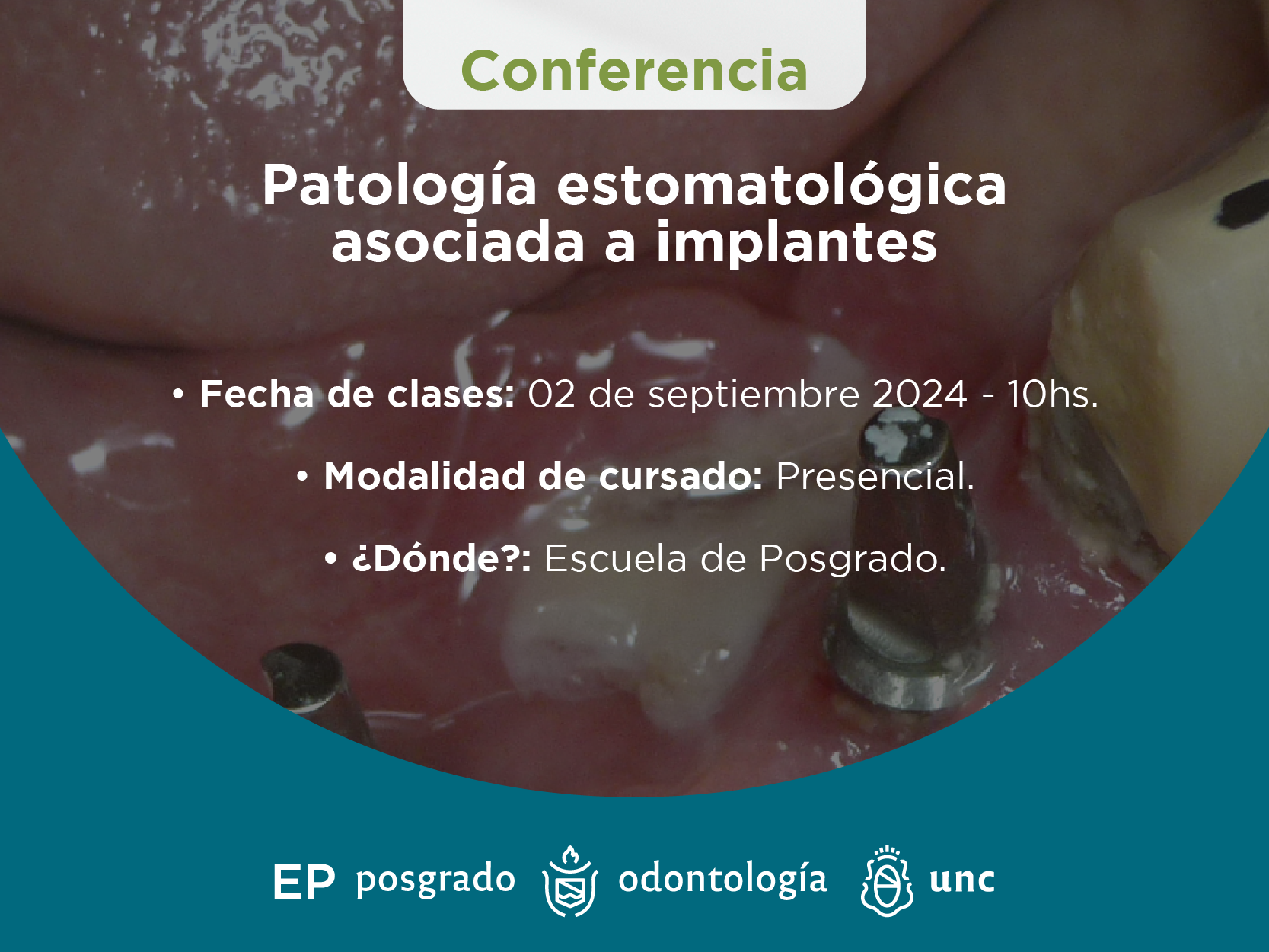 Patología estomatológica asociada a implantes. 