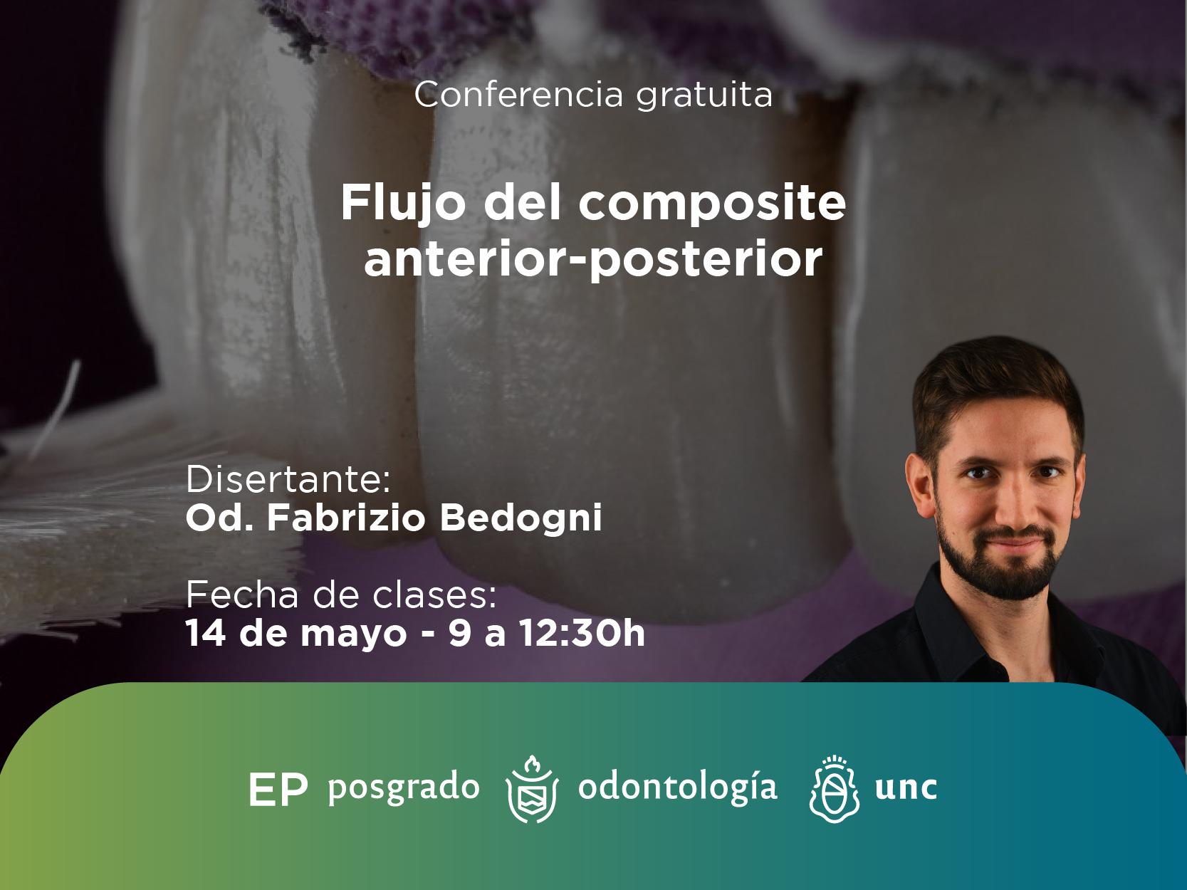 Conferencia gratuita: Flujo del composite anterior-posterior.