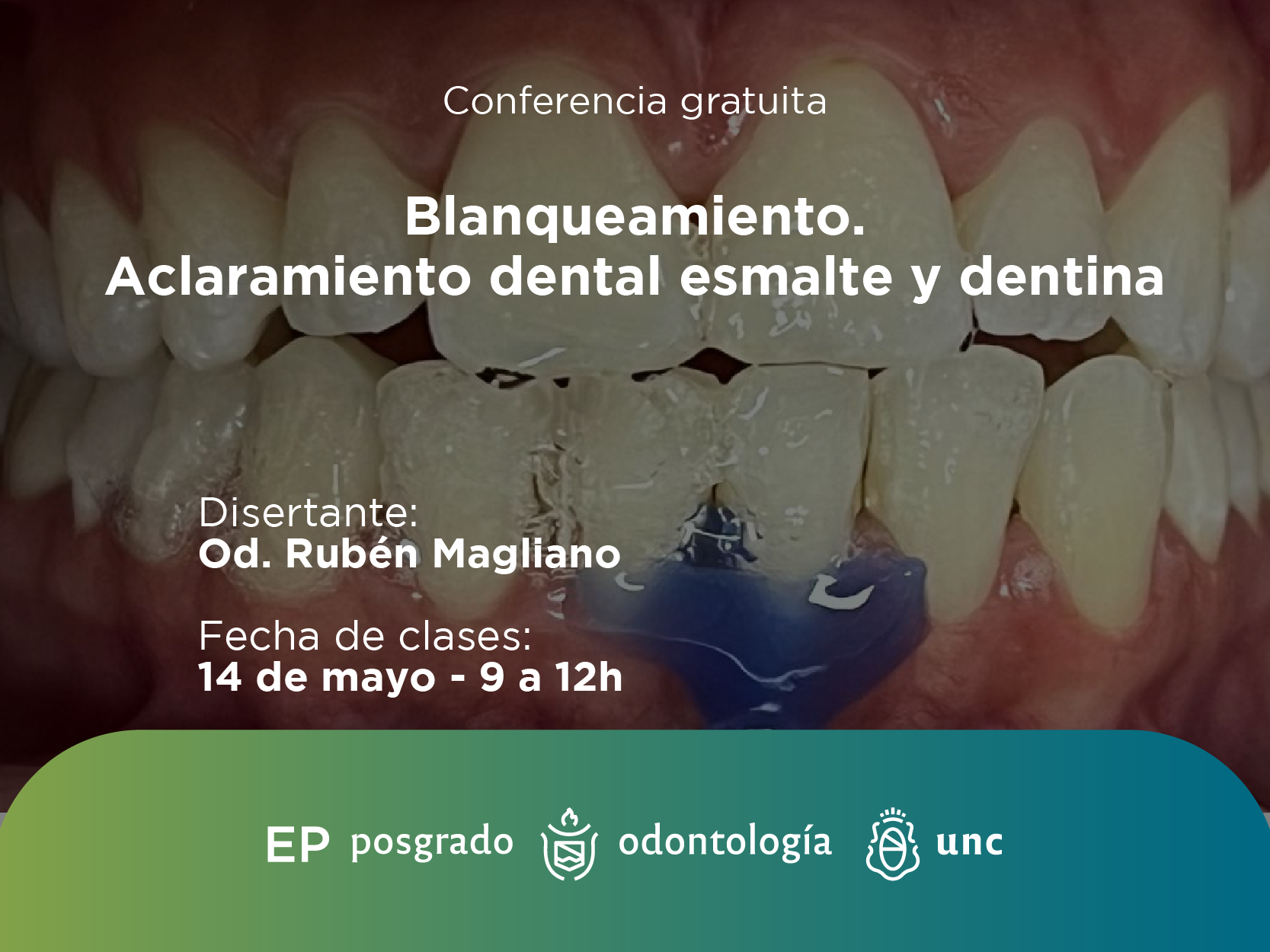 Blanqueamiento. Aclaramiento dental, esmalte y dentina.