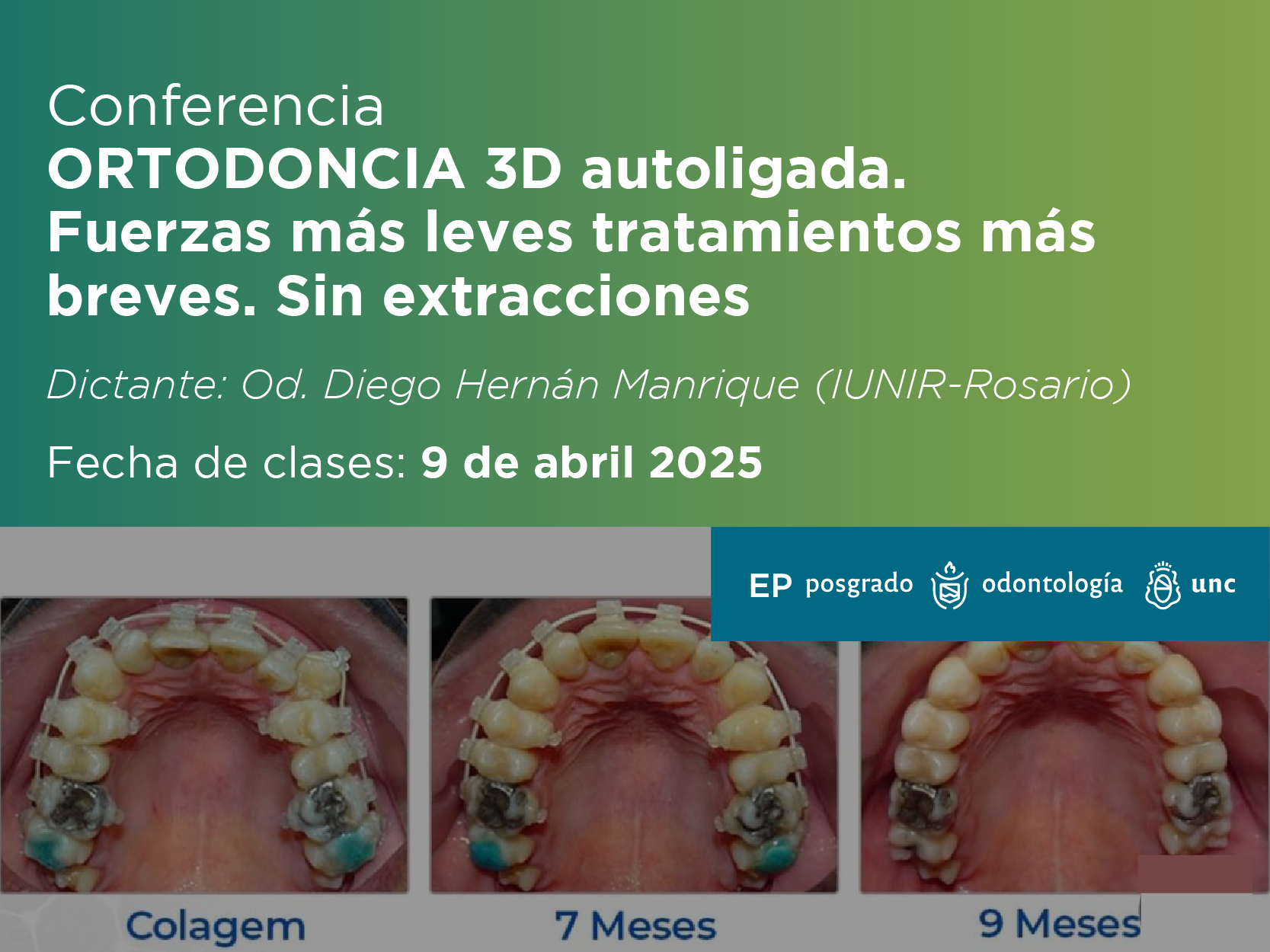 Conferencia: ORTODONCIA 3D autoligada. Fuerzas más leves tratamientos más breves. Sin extracciones.