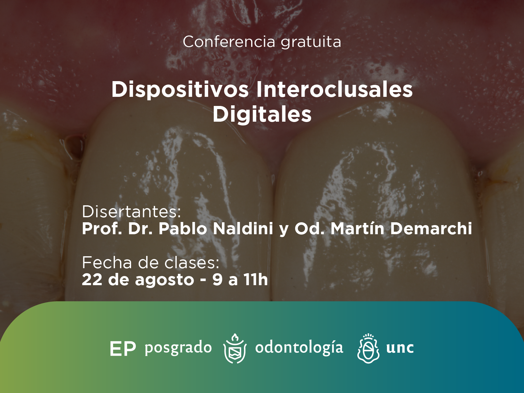 Conferencia gratuita Dispositivos Interoclusales digitales. Diseño y Producción.2025.