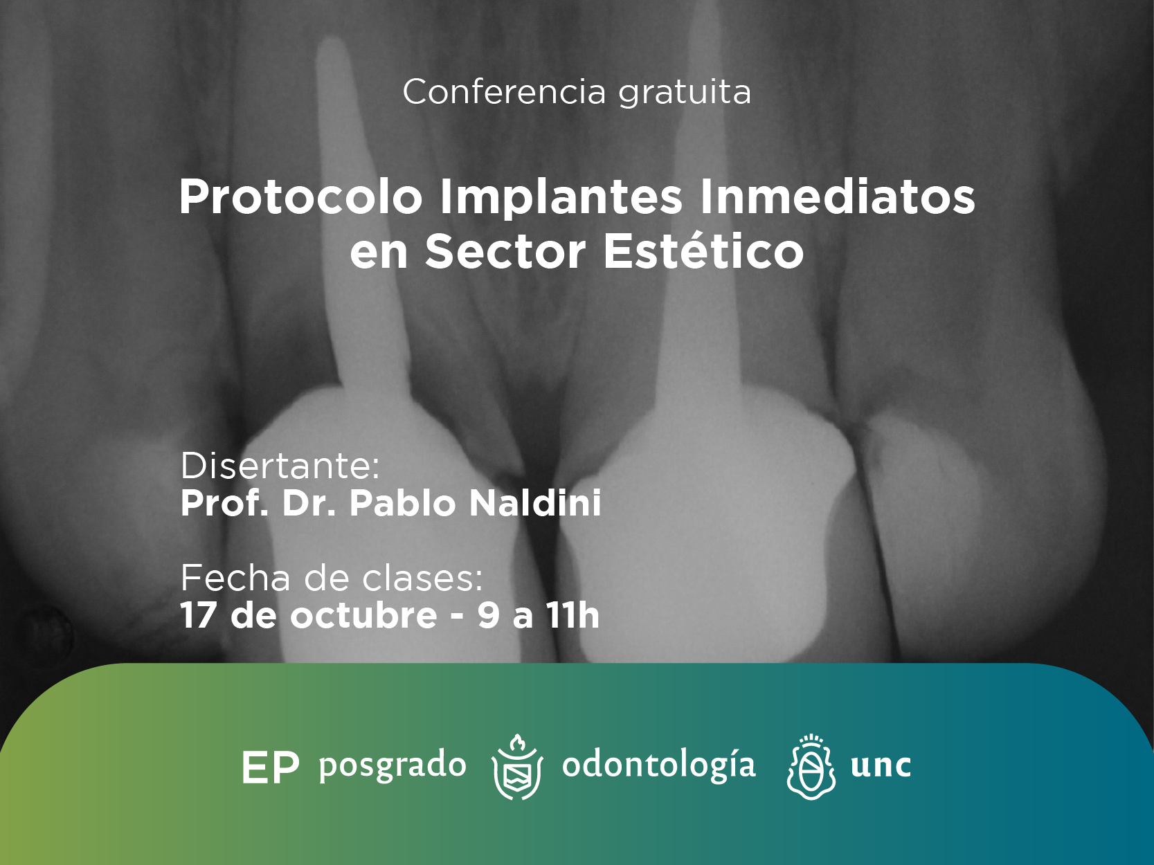 Conferencia gratuita Protocolo Implantes Inmediatos en Sector Estético.