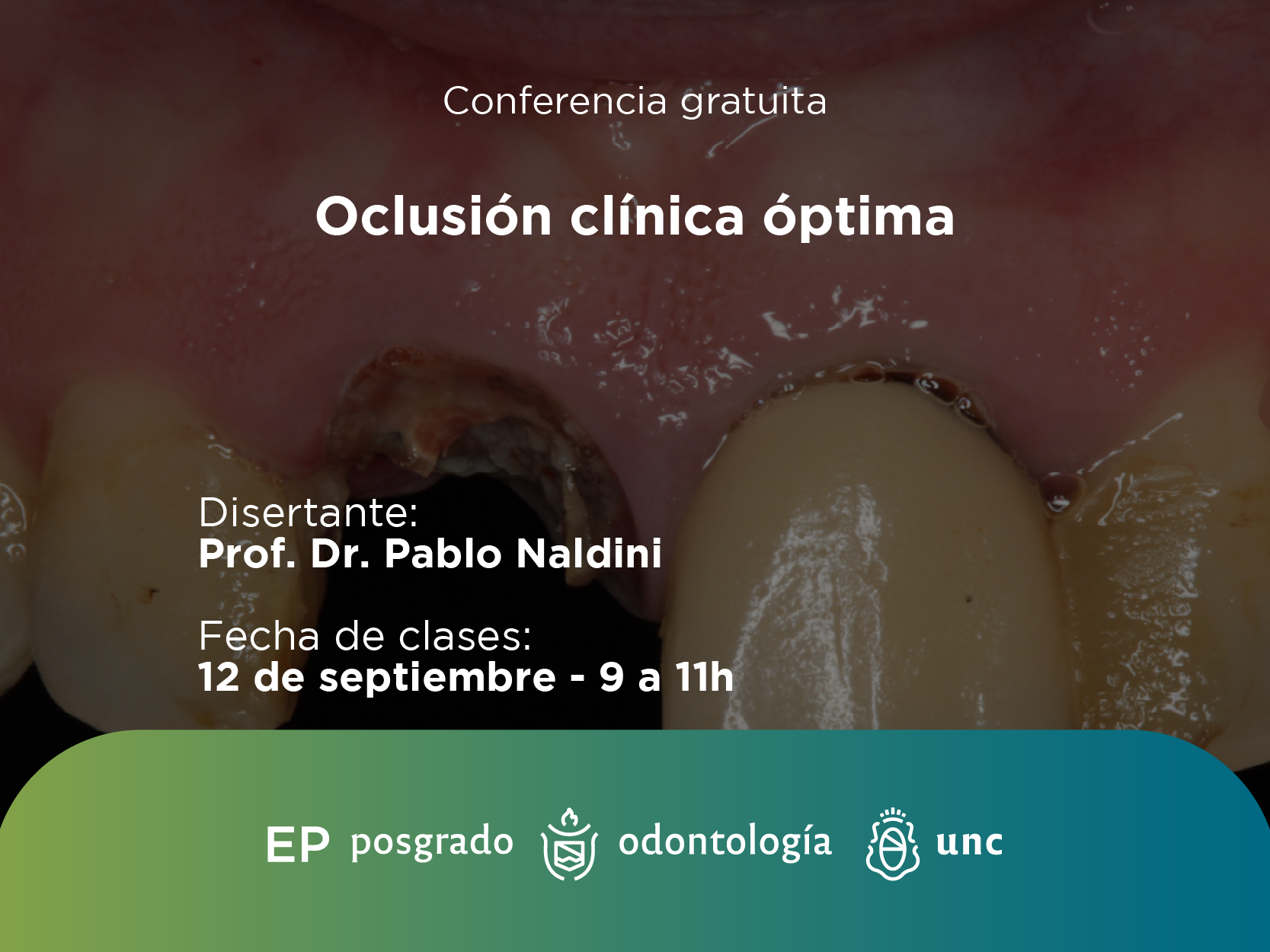 Conferencia gratuita Oclusión Clínica Óptima.2025.