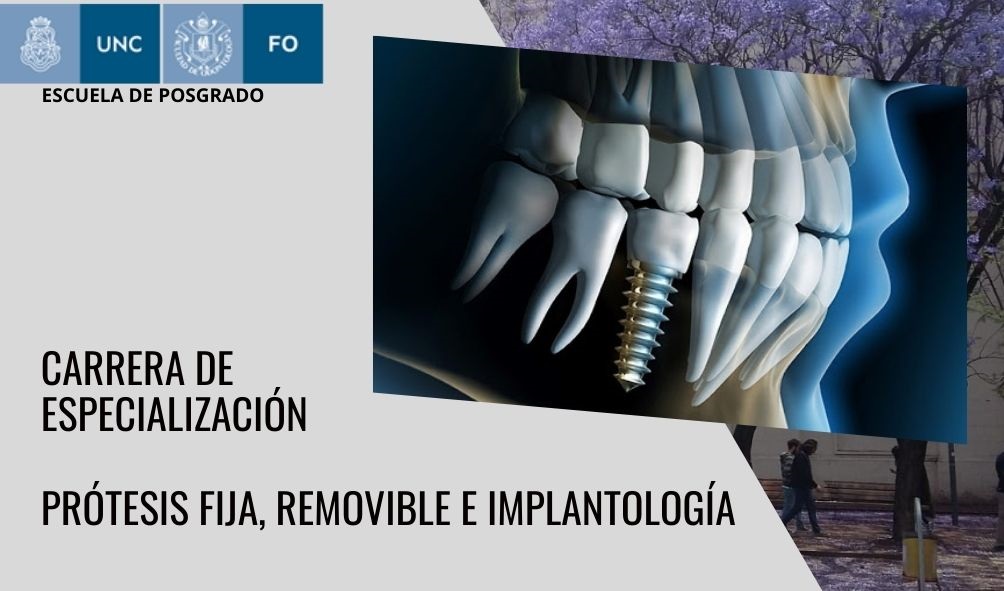 Prótesis Fija, Removible e Implantología